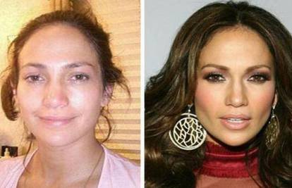 J.Lo tvrdi: Nikad nisam bila na bilo kakvoj plastičnoj operaciji