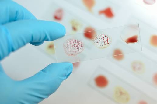 Što je to 'zlatna' krvna grupa? Imaju je 43 čovjeka na svijetu