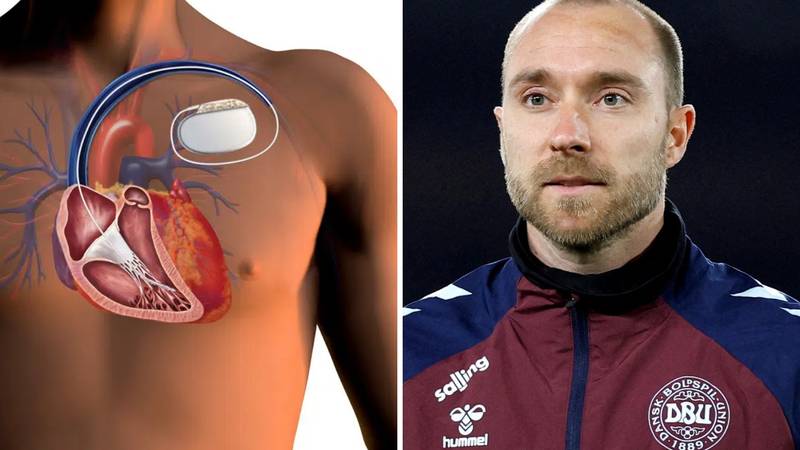'Živim s istim uređajem kao nogometaš Eriksen. Sve radim, al