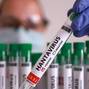 Illustration shows test tubes with "Hantavirus positive" label