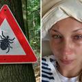 Bella Hadid već dugo boluje od lajmske bolesti: Ovo su ključni znakovi i savjeti za prevenciju