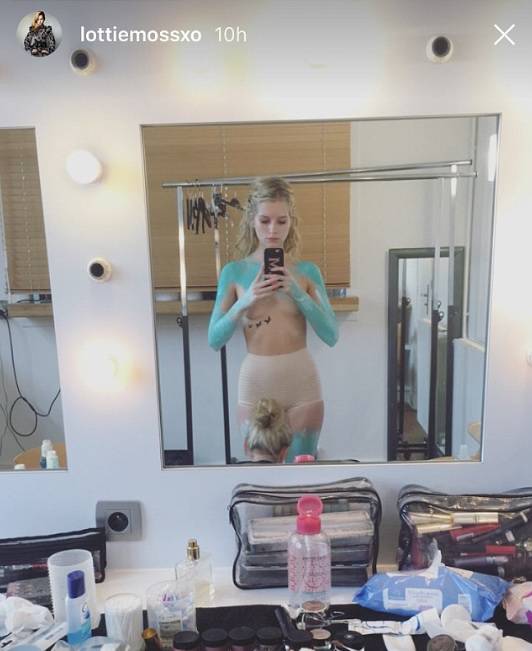 Voli golišave 'fotke': Kate Moss ima provokativnu polusestru