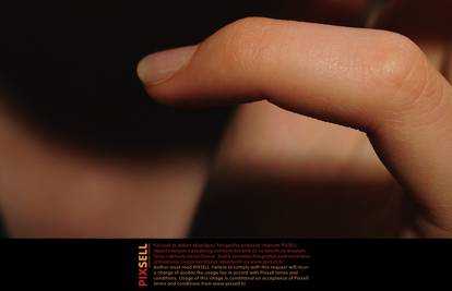 Gel-manikure osim što štete noktima izazivaju i rak kože?