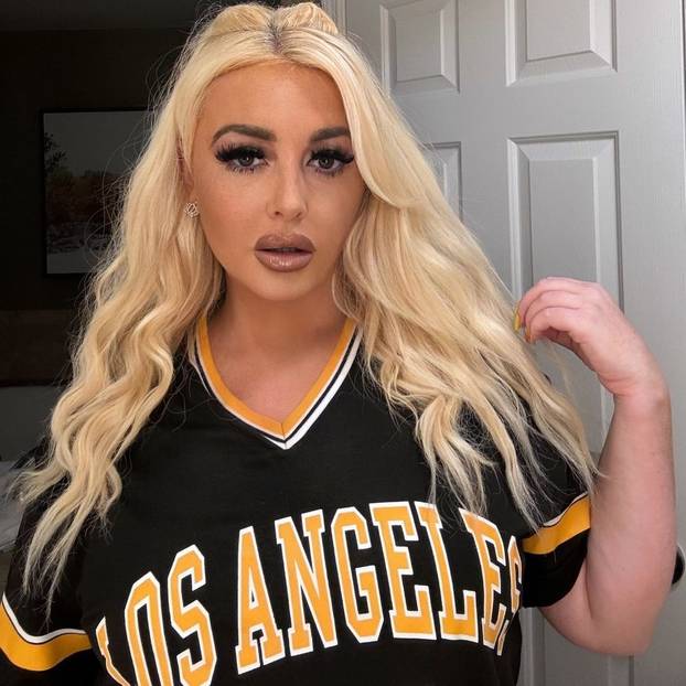 FOTO Bujnoj influencerici ova fobija otežava život: 'Bojim se!'