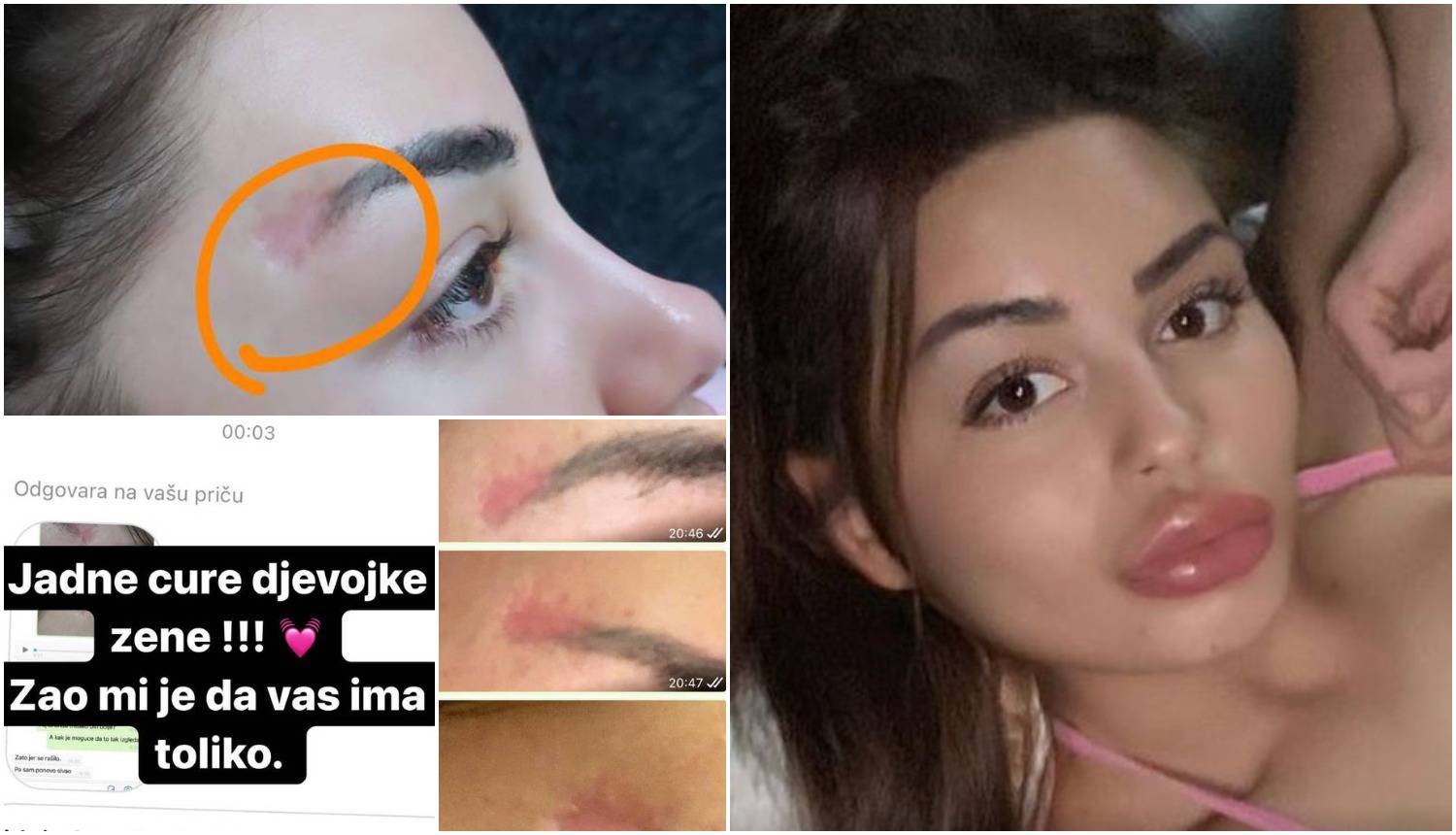 Kristina Mandarina objavila je fotografije ožiljaka: 'Nemojte dozvoliti da vam se ovo dogodi'