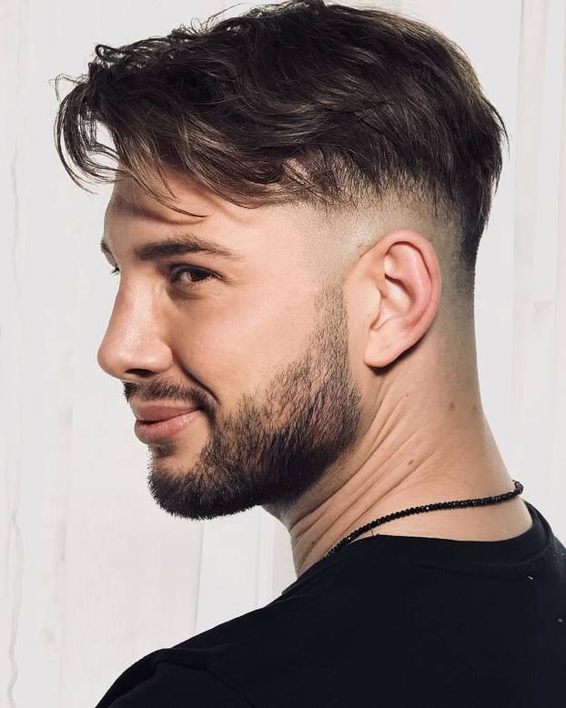 FOTO Zbogom, ćelavosti! Ovi su slavni muškarci presadili kosu: Ovako su izgledali nekada i sad