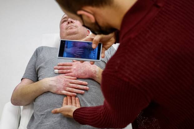 Former Ukrainian serviceman, who was wounded at a front line, comes to a clinic to treat scars, in Kyiv