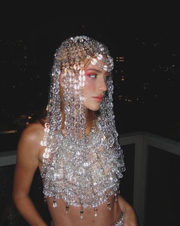 FOTO Posebna ljepota: Milijuni ljudi obožavaju njezine pjegice