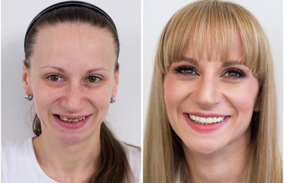 Humanitarni makeover Štimac centra dentalne medicine