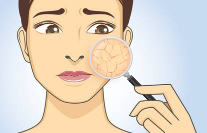 6 sastojaka iz krema za lice koje osjetljiva koža ne podnosi