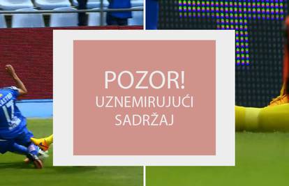 Nije za one slabijega želuca: Užasan lom noge Musacchija