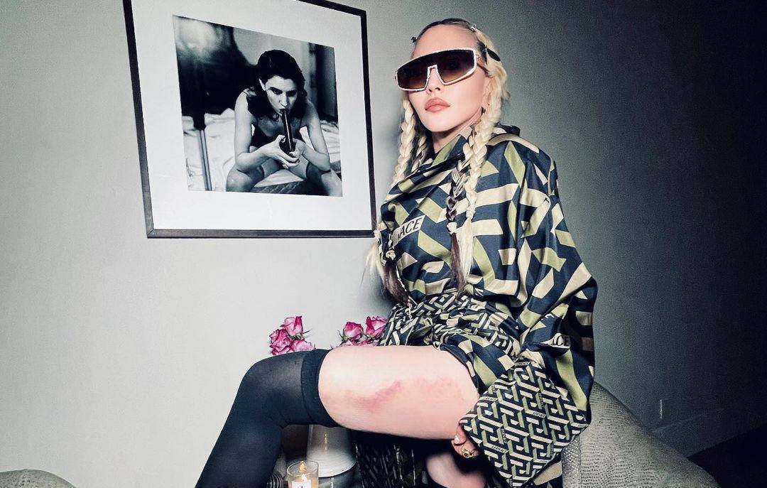 Madonna pozirala u čipkastom grudnjaku i fanove zabrinula modricama: 'Život me prebio!'