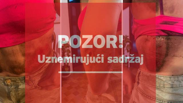 Policija otkrila koja kazna čeka vozača ZET-a koji je u Zaprešiću vukao djevojku (17) po ulici...