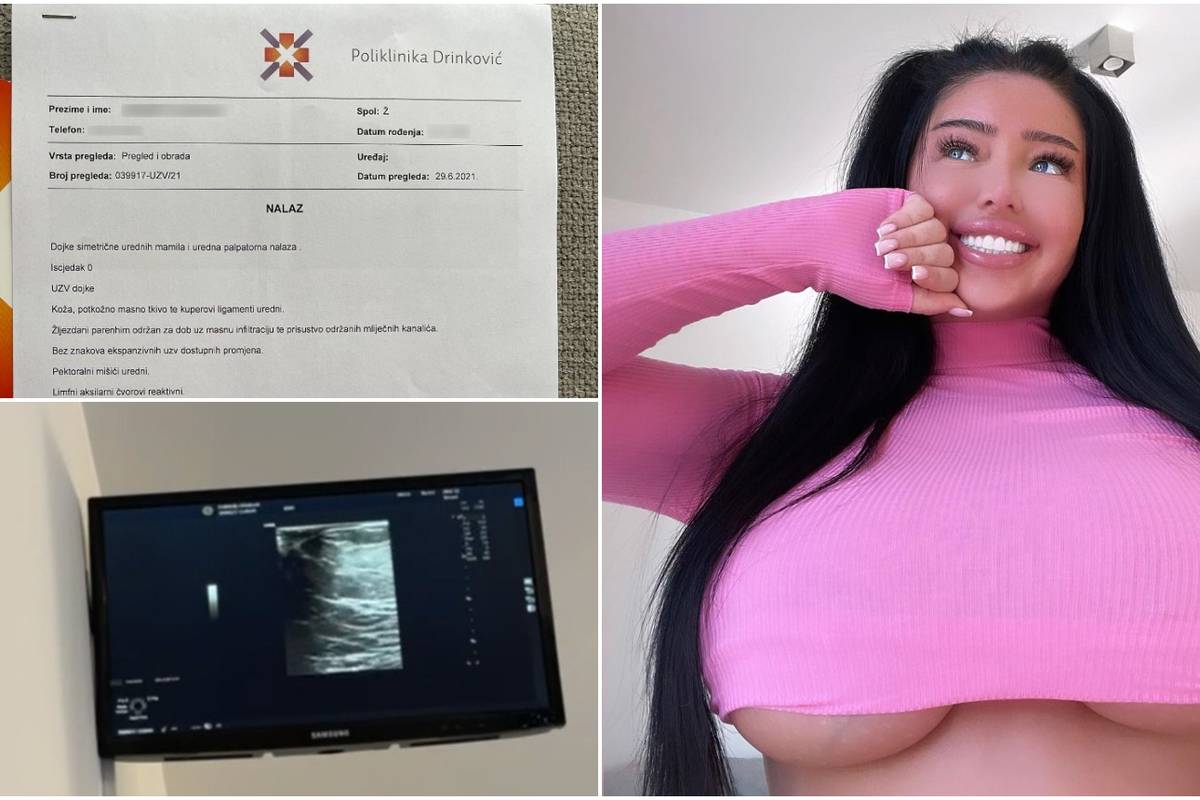 Slavonka Claudia ultrazvukom dokazala da su grudi prirodne, doktor: 'Kao od majke rođene!'