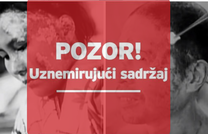 'Ljudi isprva nisu shvatili što se dogodilo. A onda su im počeli izlaziti  gnojni mjehurići po koži'