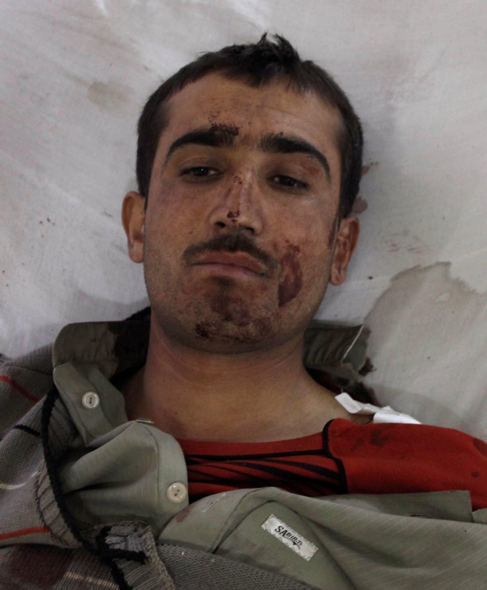 A police cadet from the Police Training Center lies in the hospital after being injured after an attack on the center in Quetta