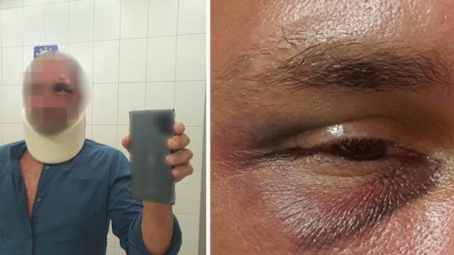 Beograđanina prebili na Korčuli 'Opsovao sam vozača  kombija, mlatili su me gdje su stigli'