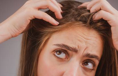 Dermatolog Kosović: Ne zanemarujte prhut - ako je ne liječite moguć je gubitak kose
