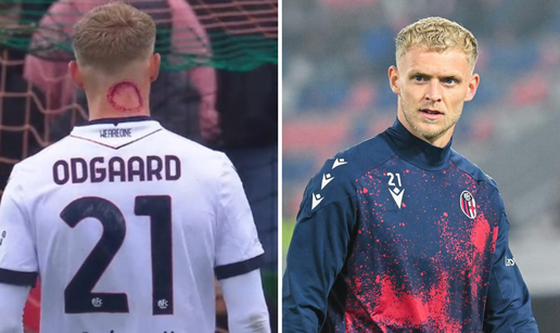 Zaigrao s jezivim ožiljkom na vratu: 'Nije me ugrizao zombi!'