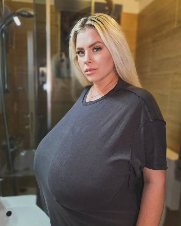 FOTO Grudi joj rastu iz dana u dan: 'Više im ne znam veličinu, nosim grudnjake po mjeri'