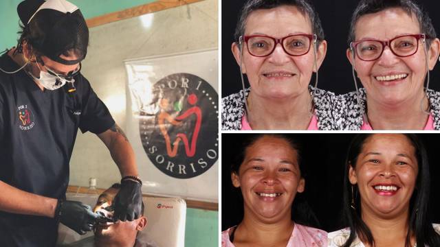 Stomatolog iz Brazila putuje svijetom i siromašnim ljudima besplatno popravlja zube