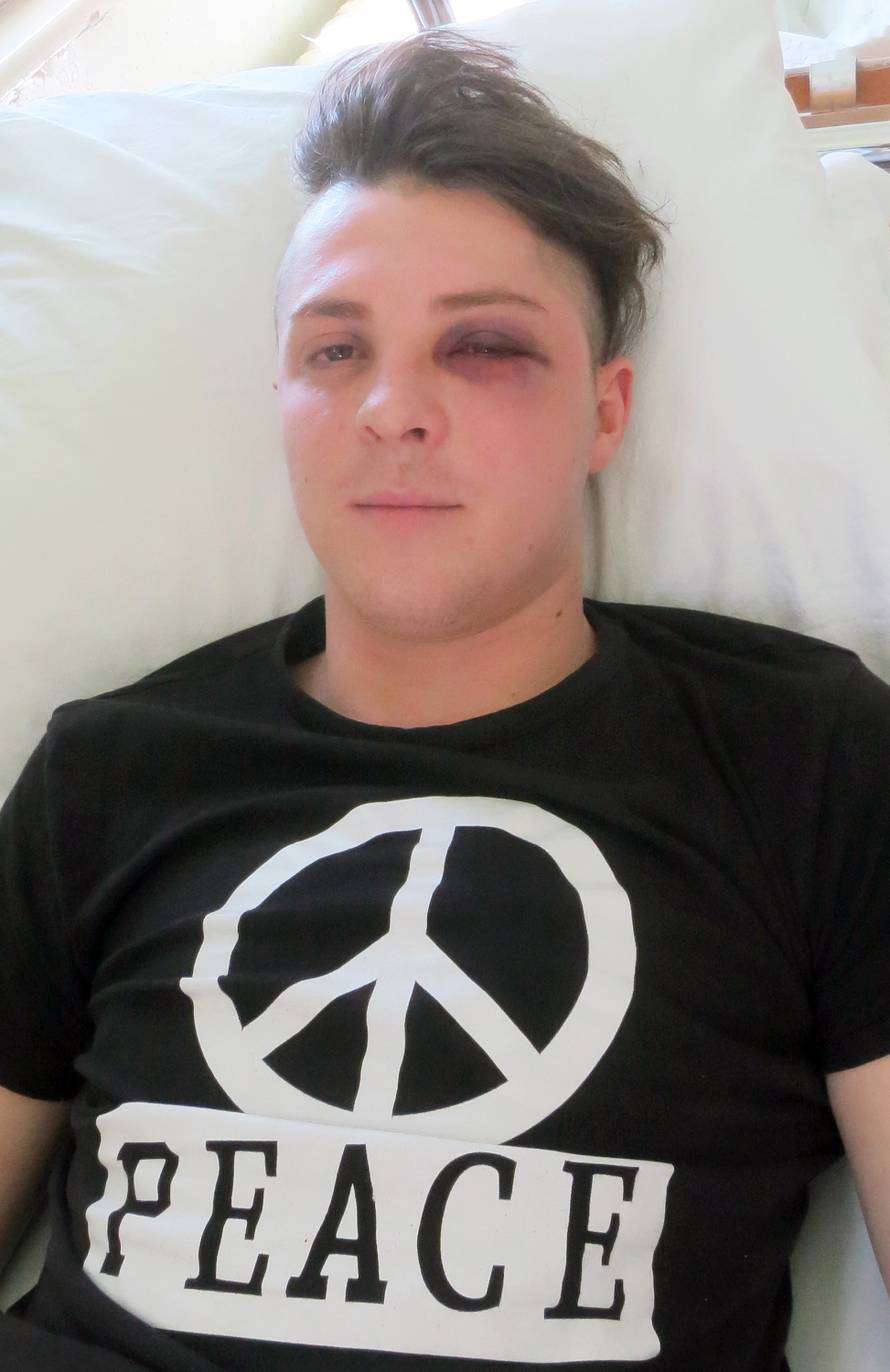 Zaručnik Ane iz Big Brothera je tukao mladića nasred ceste