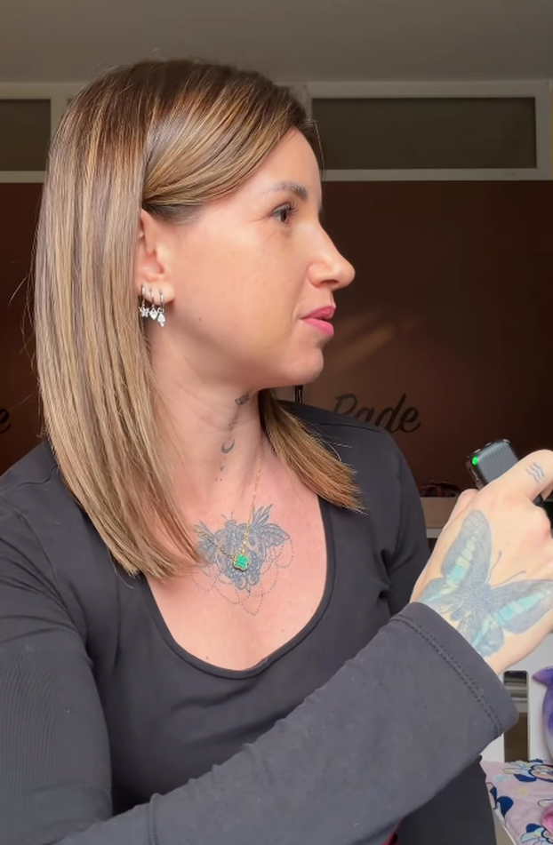 FOTO Sestra Stele Rade išla na estetske zahvate: Pokazala je rezultate, evo kako izgleda...