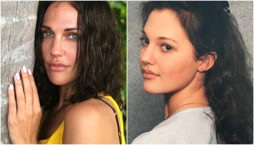 'Više ne liči na sebe': Ovako je Hurem izgledala prije operacija