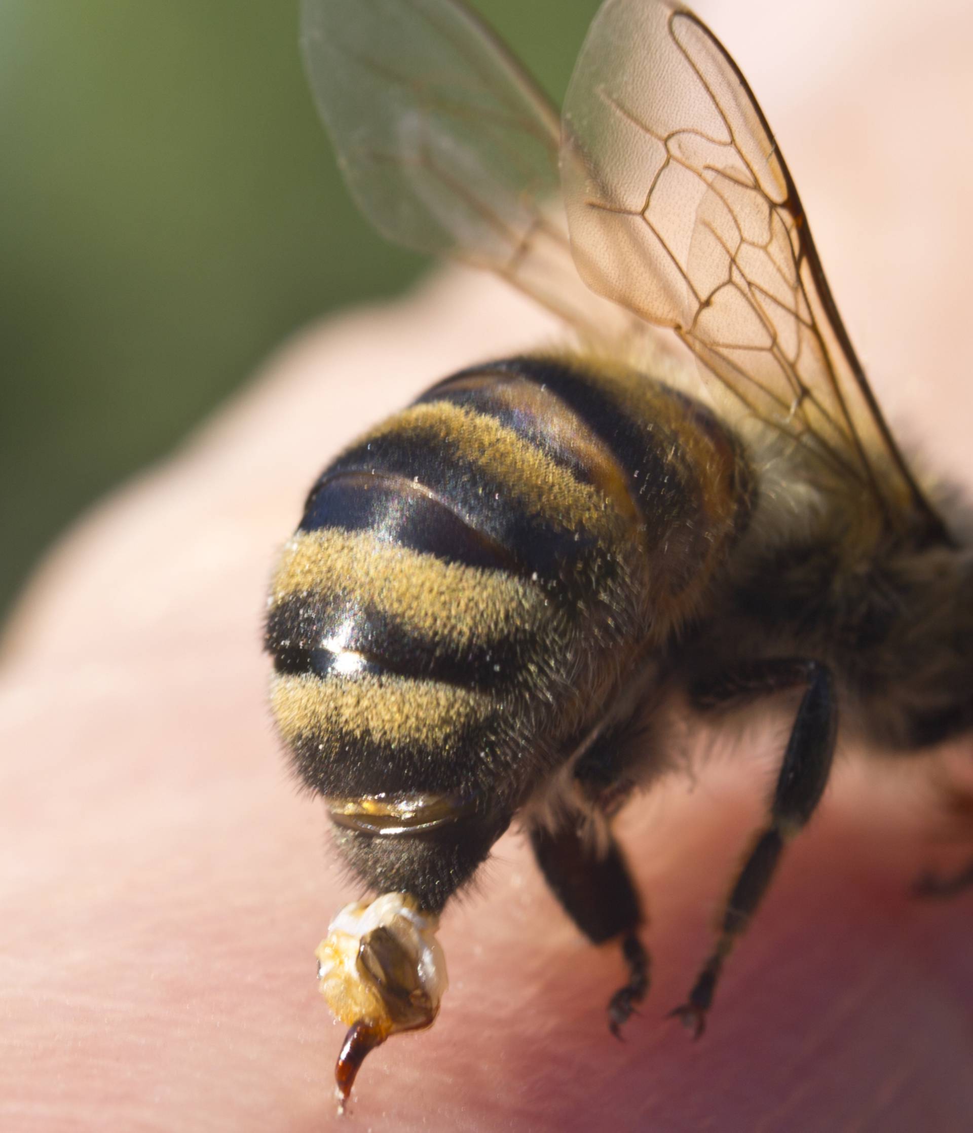 Super trik kako spriječiti bol i oticanje od uboda pčele, ose...