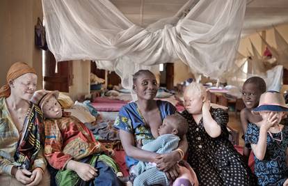 Albino utočište: Ovdje im nitko ne želi nauditi jer su drugačiji