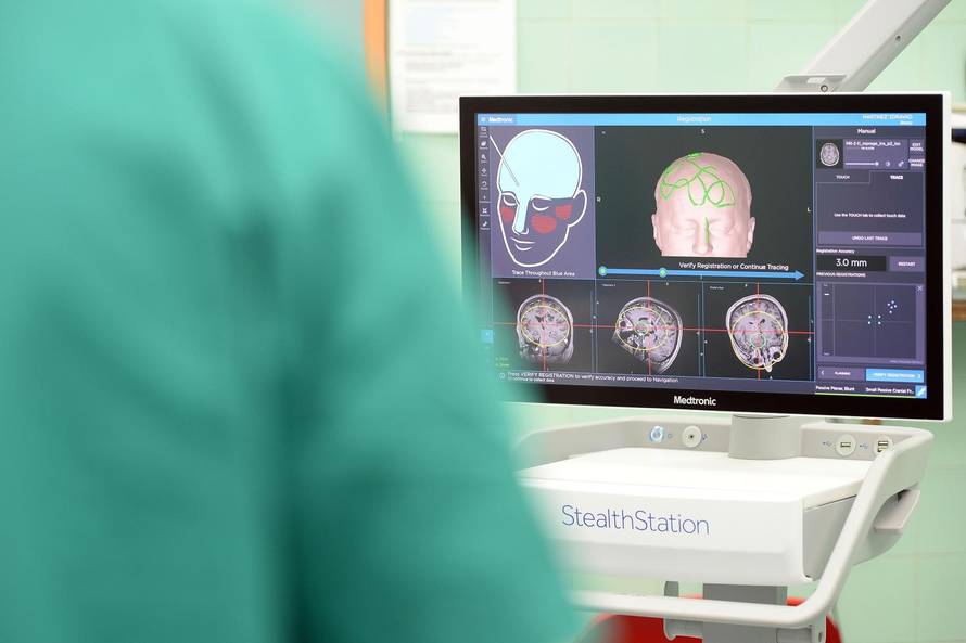 U Varaždinu imaju ‘GPS’ za operacije mozga i kralježnice