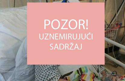 Osjetila je mučninu, pojavio se osip, a sada će ostati bez nogu