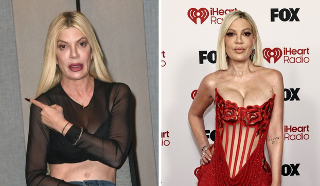 FOTO Bivši suprug joj vratio stare implantate, a novi vriju ispod ružica u korzetu