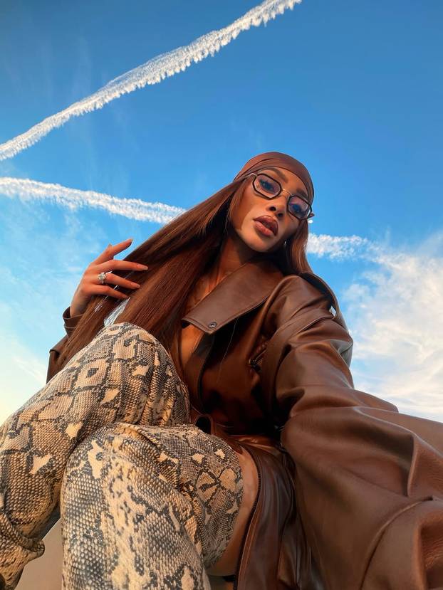 FOTO Rugali su joj se zbog bolesti, a danas je obožavaju zbog jedinstvenog izgleda