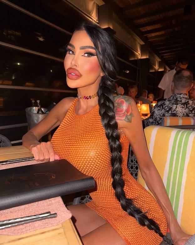 FOTO Potrošila više od 100 tisuća eura kako bi izgledala kao 'ljudska barbika' - Liječnici zgroženi