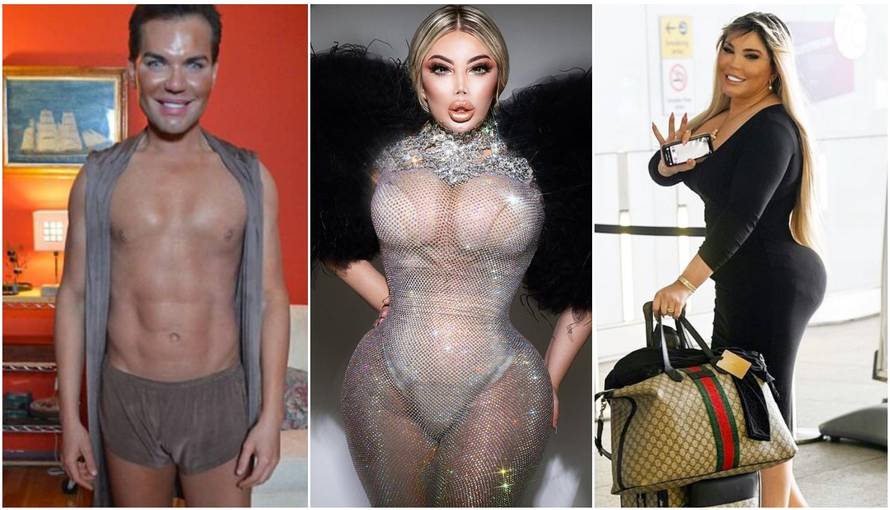 Bivši 'ljudski Ken': 'Muškarci vide da sam transrodna žena. Preplaše se, a nekima je fetiš'