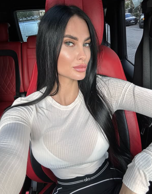 FOTO Evo kako izgledaju naši slavni bez photoshopa i filtera