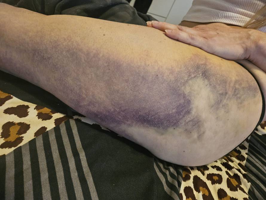 Super Silva za 24sata: Znam tko me napao, bilo je iznenada i s leđa. Jedna noga mi je uništena