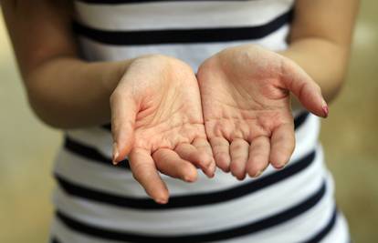 Ovako posložene linije na dlanu nemaju svi, a otkrivaju iznimne ljude koji znaju zaraditi novac