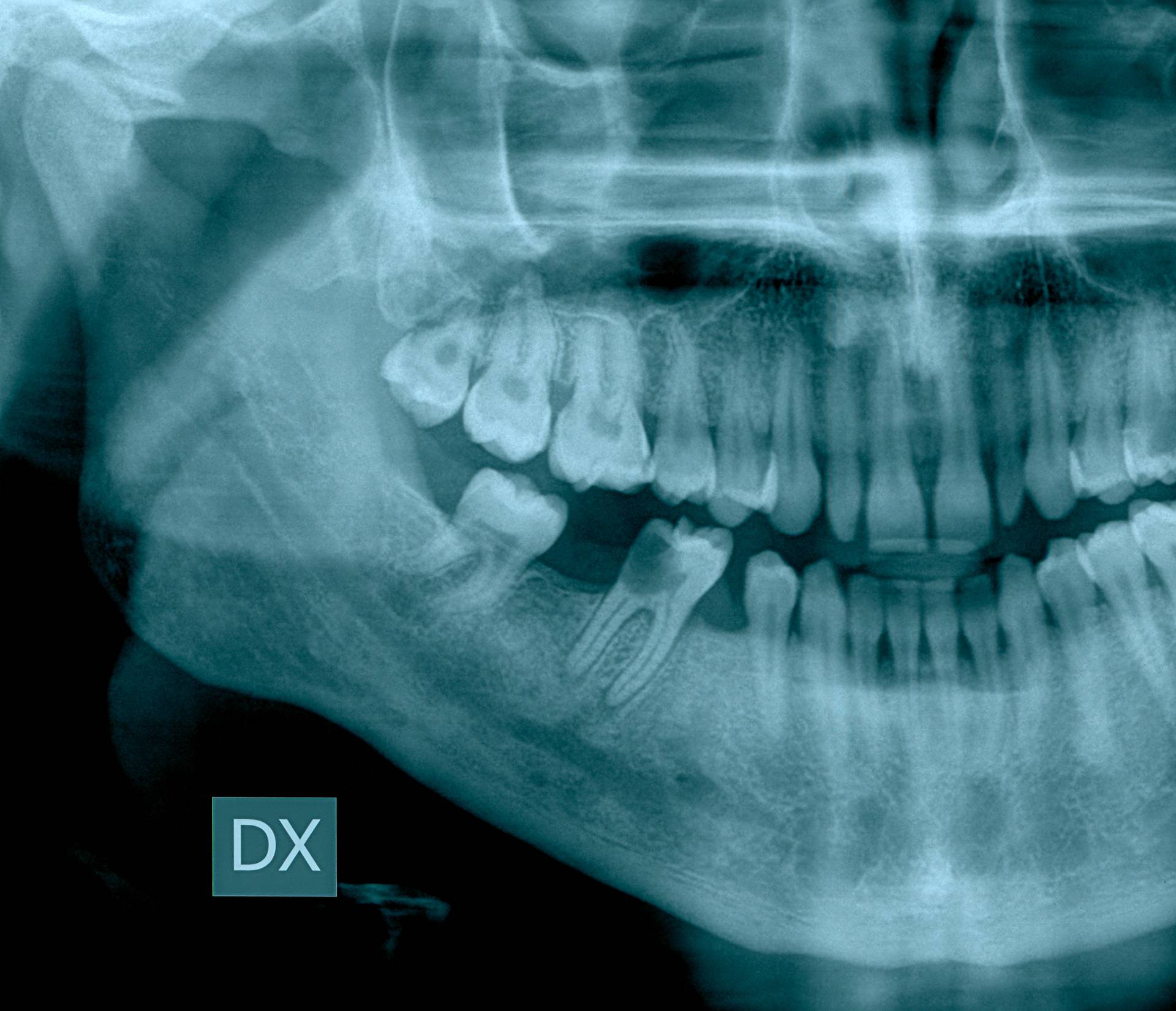Koji zub vas boli? To otkriva problem s određenim organom