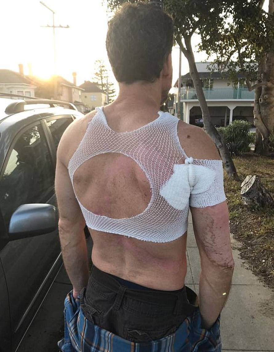 Dramatičan video: Otac i dvoje djece preživjeli su udar munje