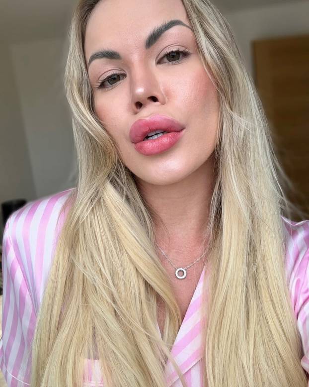 FOTO Brazilka upozorava: Ne snimajte na - 10 na snijegu! Ja sam dobila ozebline na guzi...'