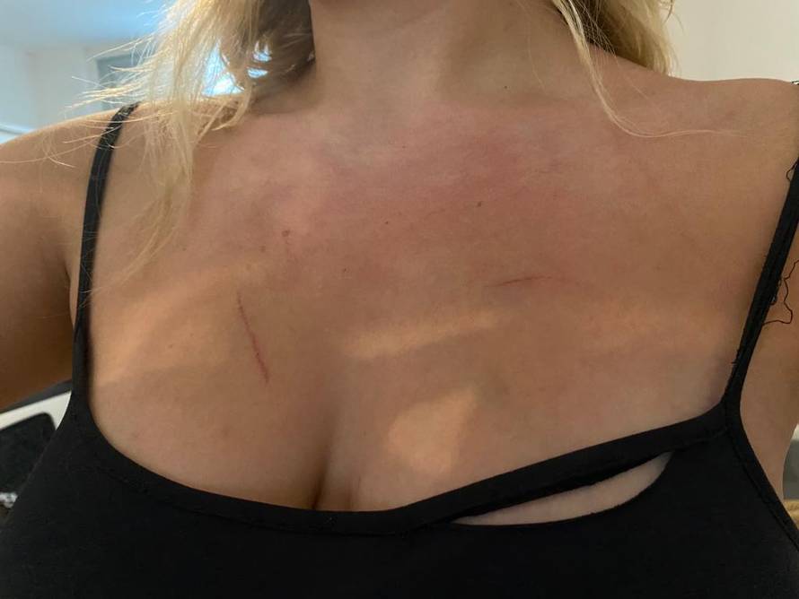 VIDEO Vlasnica (60) restorana napala dvije konobarice: 'Bacila me na ormar i uzela mi novac...'