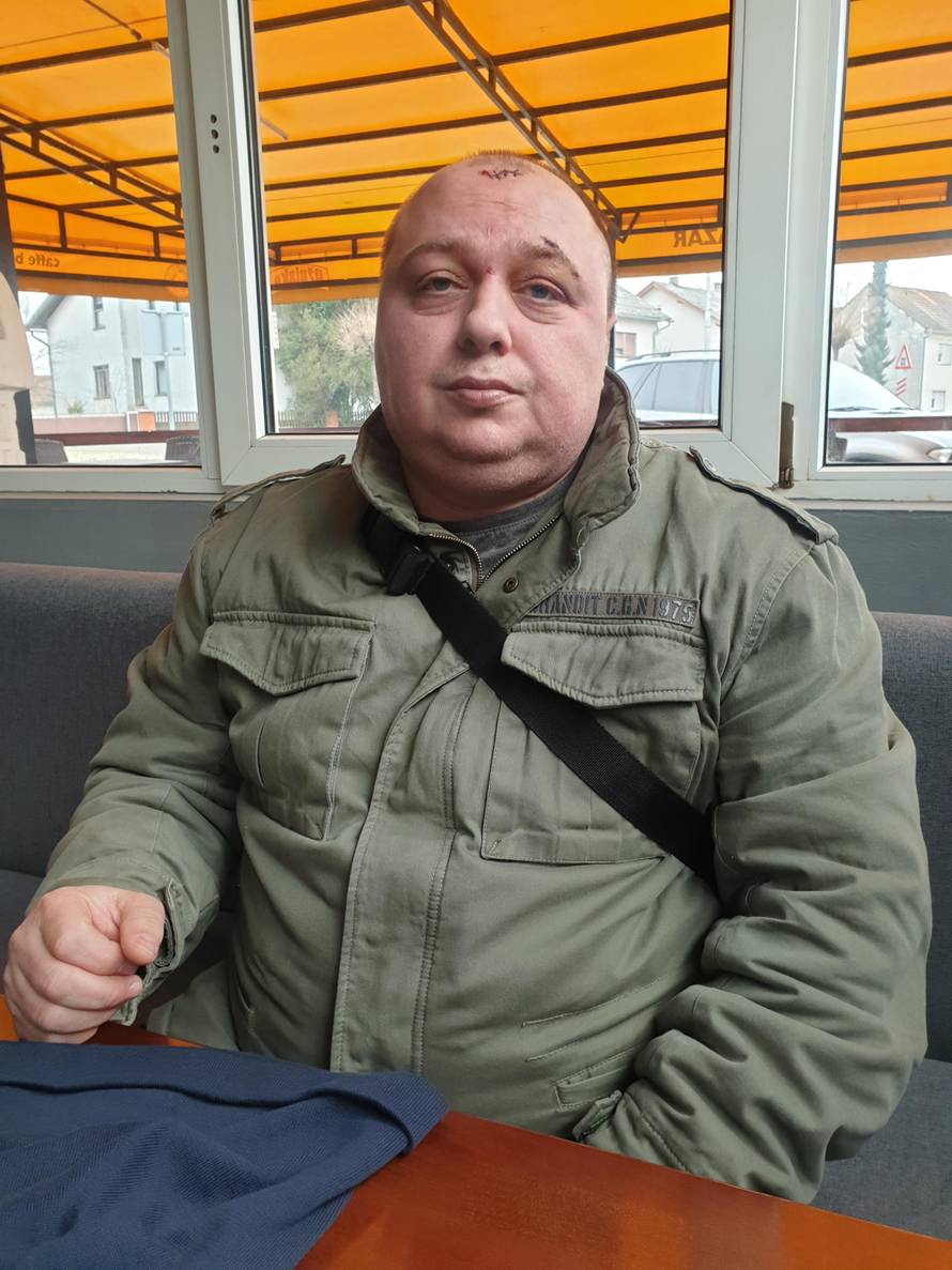 'Prvi me tukao šakama, a drugi me pepeljarom udarao po glavi'