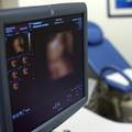 Prekid trudnoće je dio liječničke specijalizacije za ginekologe