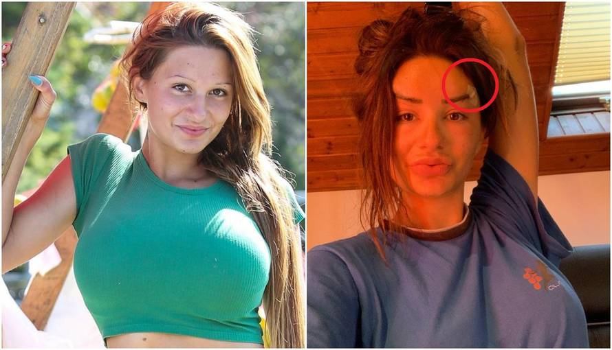 Kristina opet pod nožem? Bez šminke i filtera, ali s flasterima