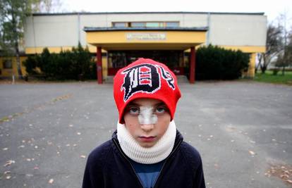 Dječje nasilje: Đaku ispred osnovne škole slomio nos 