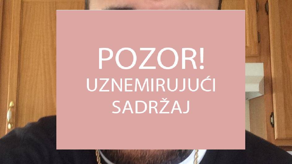 Reper upucao sam sebe u lice zbog potreba glazbenog spota