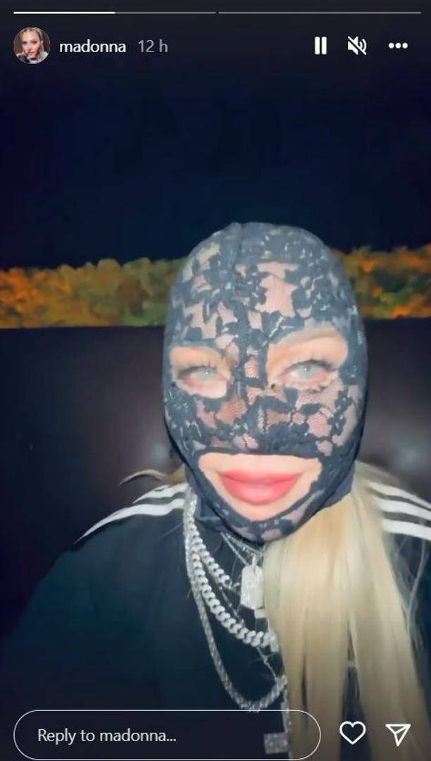 'Kraljica popa' stavila čipkastu masku na lice, a onda fanove iznenadila dijamantnim zubima