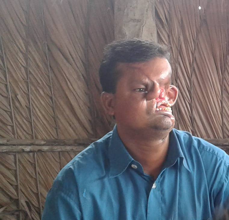 EXCLUSIVE
Fishermen Attacked by Tiger shows his face for the first time.